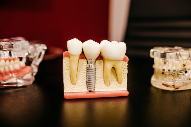 你知道植牙有保險可以賠嗎？